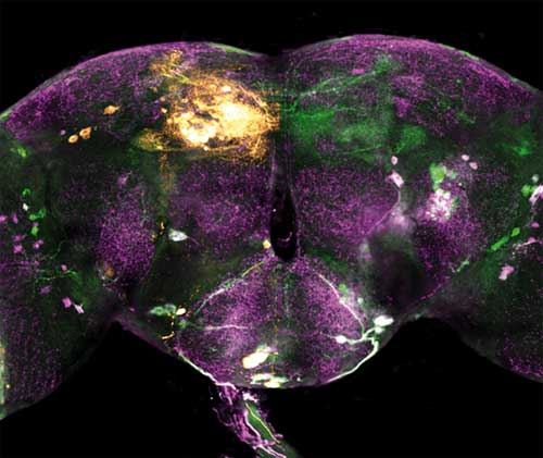 Montage de deux hémisphères cérébraux. Crédits : neurobiologie/Espci ParisTech 